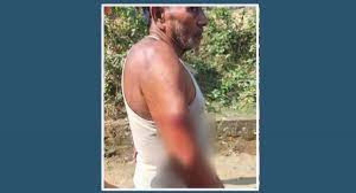 মিয়ানমার থেকে আসা গুলিতে দুজন আহত